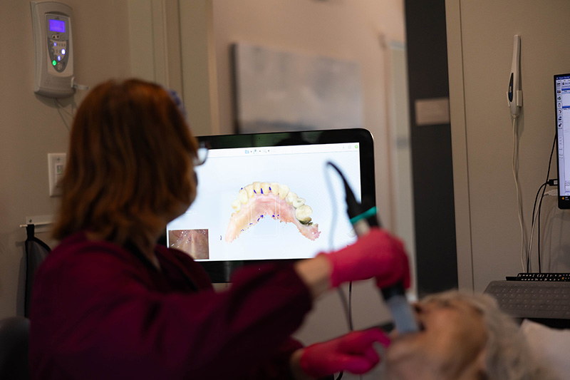 Intra-Oral Camera
